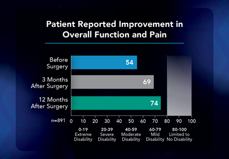 Knee replacement graphic